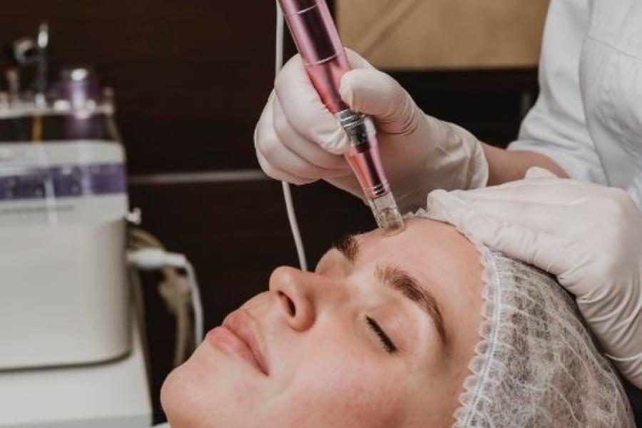 The Science Behind Micro-Needling: How It Can Transform Your Skin