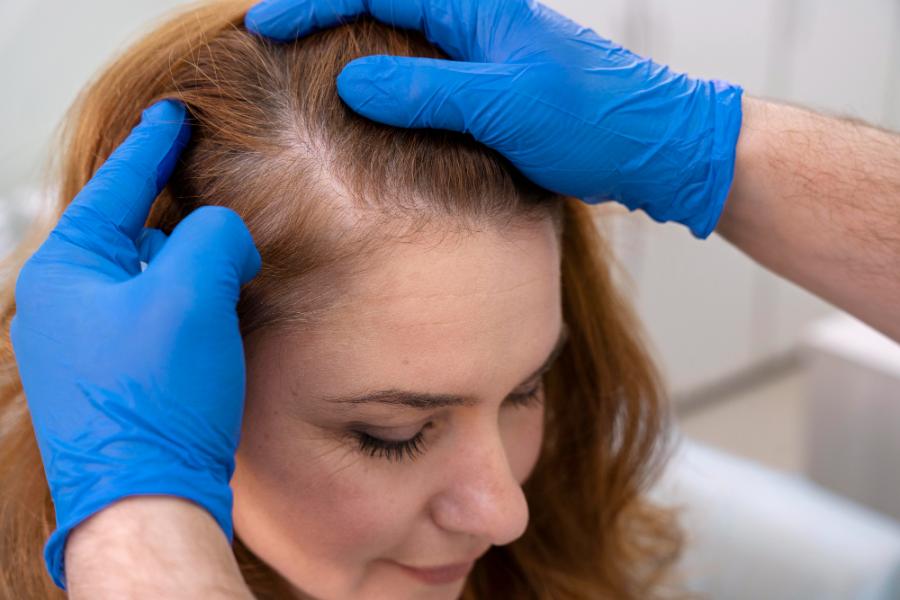 Scalp Health The Foundation for Healthy Hair