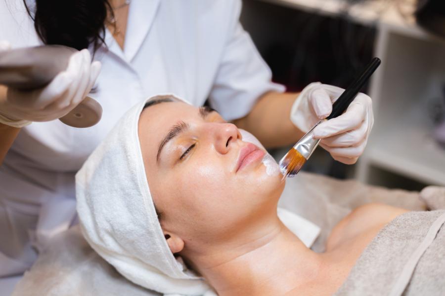Chemical Peels