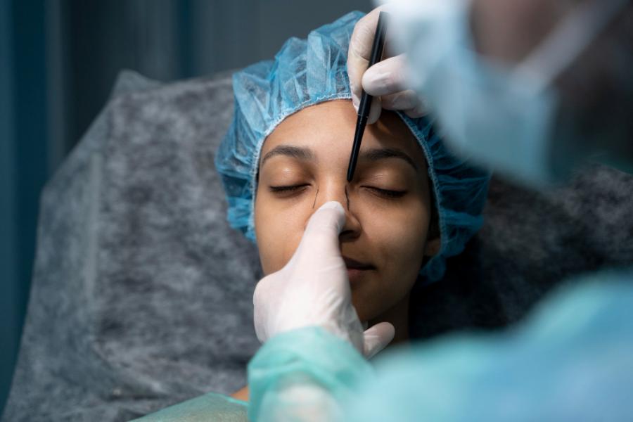 Rhinoplasty