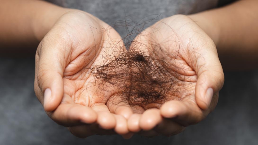 Hair Fall and Baldness treatment